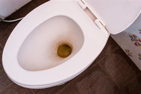 How to Remove Poop Stains from a Toilet Bowl? (7 Easy Ways)