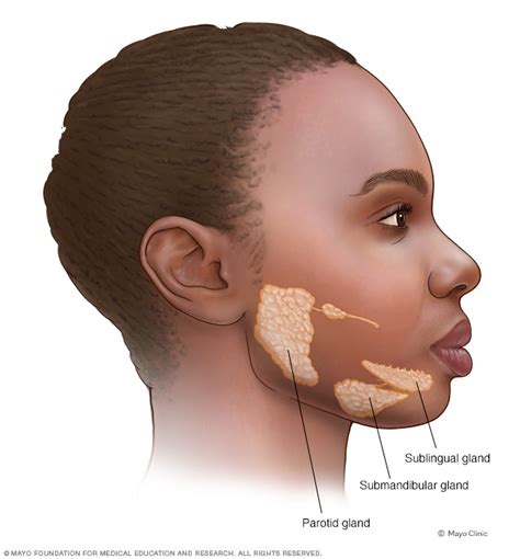 Salivary gland tumors | Beacon Health System