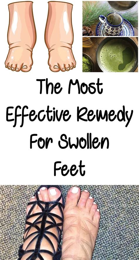The Most Effective Remedy For Swollen Feet | Swollen feet remedy, Foot ...