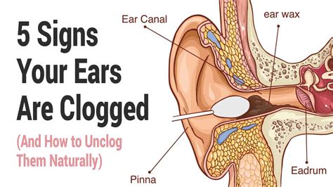 Natural Ways To Make Your Ears Drain - Best Drain Photos Primagem.Org