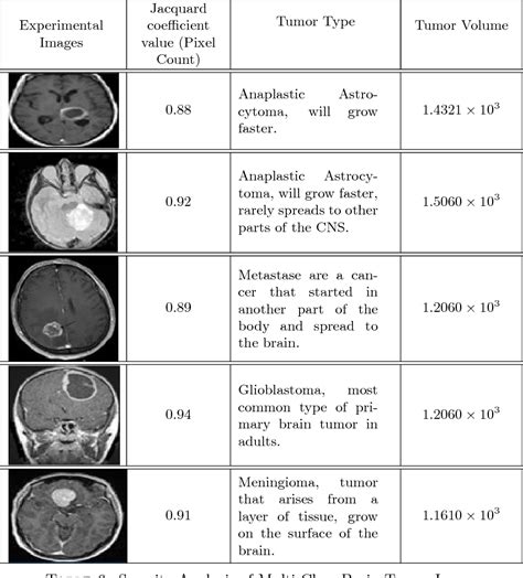 Table 6 from MULTI CLASS BRAIN TUMOR CLASSIFICATION OF MRI IMAGES USING HYBRID STRUCTURE ...