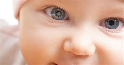 What is Congenital Cataract and when should the infant have the surgery done? | Dr Surabhi Dutt ...