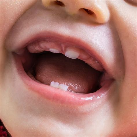 Common Questions About Baby Teeth: Answered - Ellicott Mills Dental