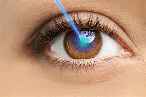 Laser Treatments for Glaucoma in Houston, TX | Mann Eye Institute