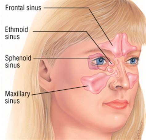 Does Sinus Infection Cause Pressure In Ears at Adele Castillo blog