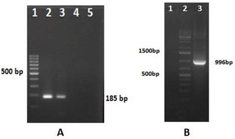 RT-PCR-amplified products of RV-D. (A) Lane 1: 100-bp DNA ladder... | Download Scientific Diagram