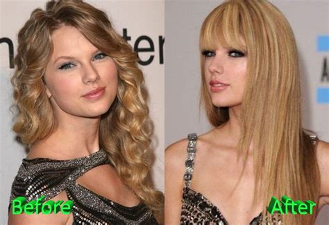 Taylor Swift Plastic Surgery Before and After