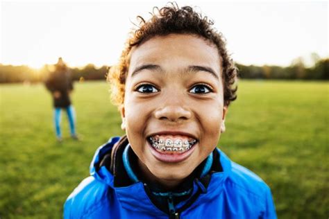 5 Most Common Types of Braces for Your Child – 2024 Guide - The Frisky