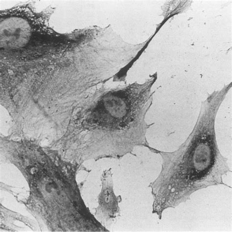 Light micrograph of human mesangial cells. Cells were grown on glass... | Download Scientific ...