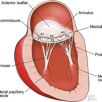 Mitral Valve Disease: a Comprehensive Review | Request PDF