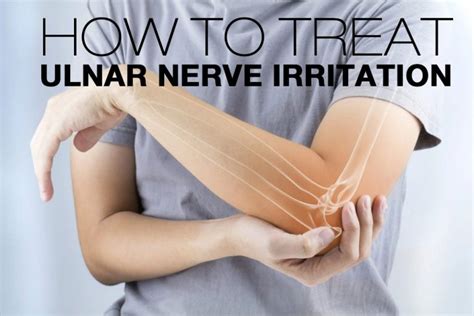 Ulnar Nerve Irritation: Symptoms, Causes, Treatment By Ulnar Nerve Irritation Braces