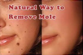 IAmJeni: Natural Mole Removal