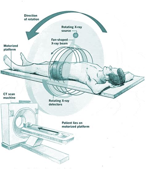 What Goes on Inside a CT Scanner? - Amber USA Blog