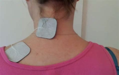 TENS unit placement for tension headaches get instant relief today (2022)