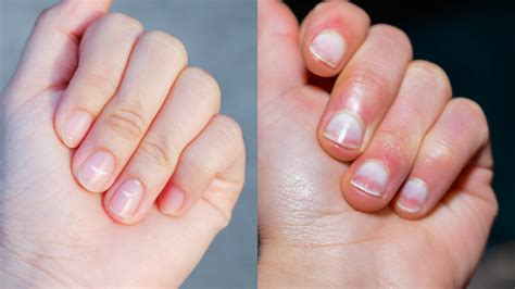 4 Possible Causes of Nail Issues | Woman's World