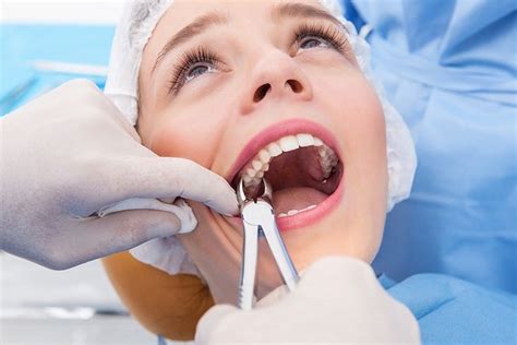 How Long Is Wisdom Teeth Surgery – Boston Dentist – Congress Dental ...