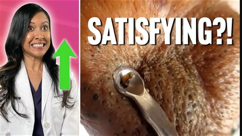 Blackhead removal videos ranked by professional blackhead remover for ...