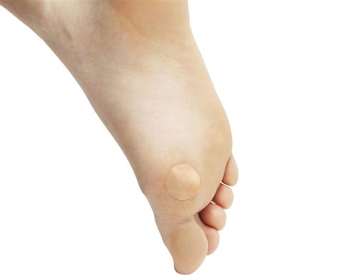 16+ Plantar Wart Patches | AlezeAkuyuma