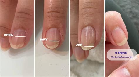 How to prevent ridges and splitting nails from affecting your day ...