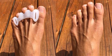 Healthy Feet Shape