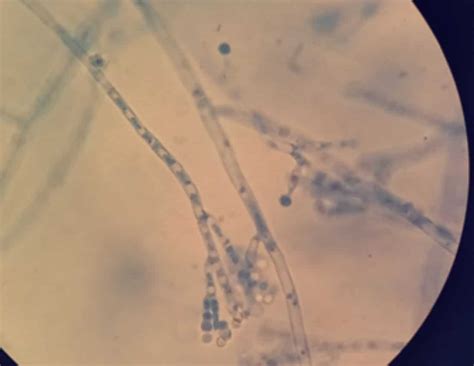 The Rise Of The Superbugs: 5 Shocking Ways Bacteria Defy Our Medication