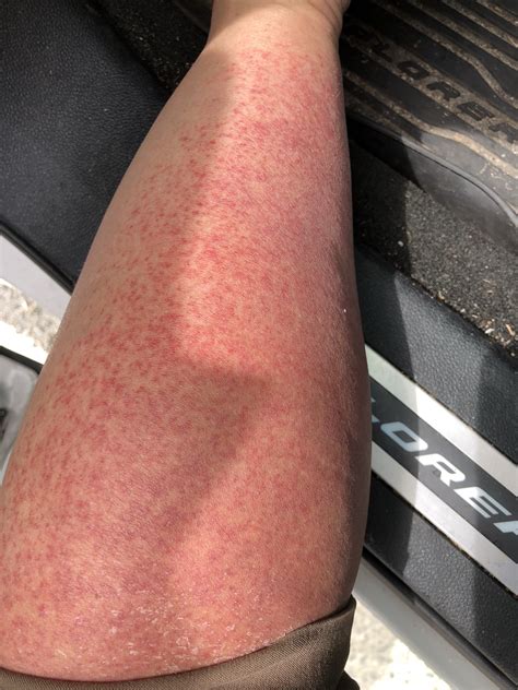 img_0731 – Revealing Character True