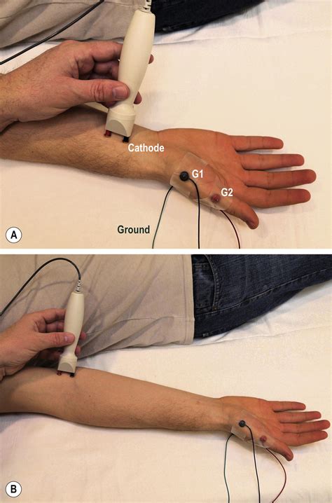 Routine Upper Extremity, Facial, and Phrenic Nerve Conduction