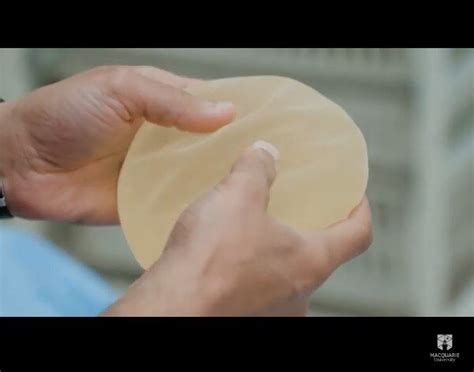 study  certified surgeons  blame   breast implant