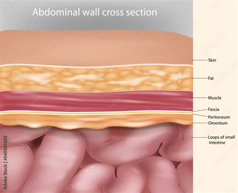 Abdominal wall cross section Anatomy. Abdominal wall layers Medical ...