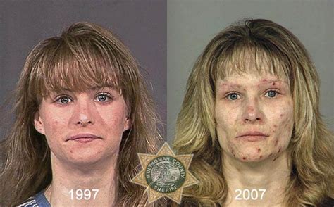 Le foto dei devastanti effetti della droga sul nostro viso. - Lo Sapevi?