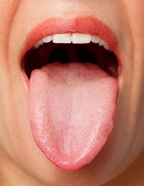 Lingua E Linguagem - Você sabia que as alterações na língua podem estar relacionadas com a ...