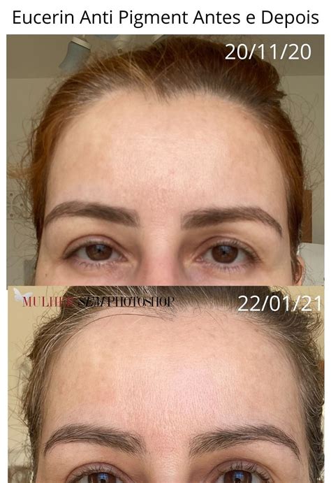 Eucerin Pigment Antes E Depois - Eucerin Anti Pigment Dual Serum, Dia FPS30 e Noite resenha completa
