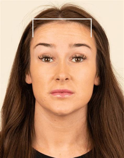 anti wrinkle injectables  women therapie clinic