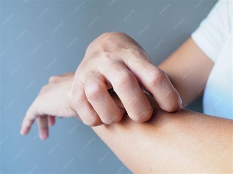 Corpo Pinicando E Coçando Remedio - Mulher coçando o corpo com coceira de doenças de pele ou picadas de ...