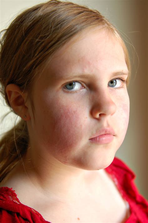 rash on the face causes 8