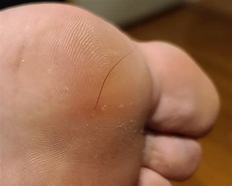 Why Do I Get Dog Hair Stuck In My Foot at Terrance Mitchell blog