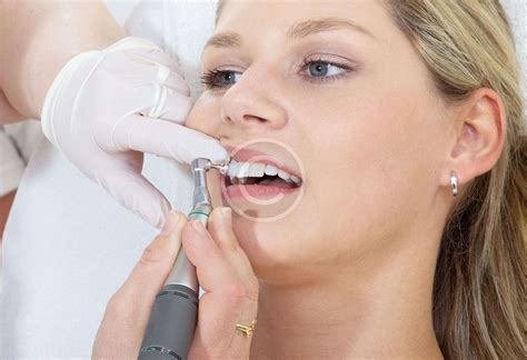 heating water in the dental line may enhance