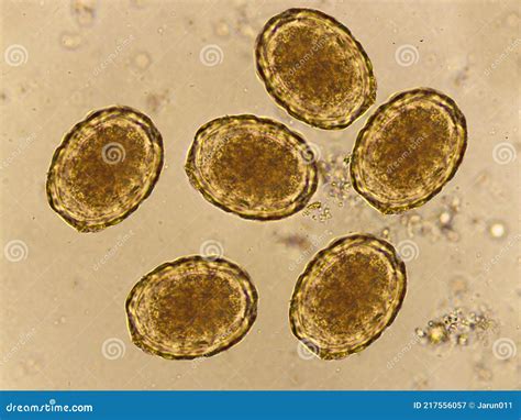 Roundworm Eggs In Humans