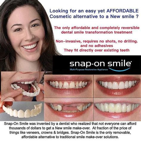 Adjustable Snap-on Dentures – Chyhua