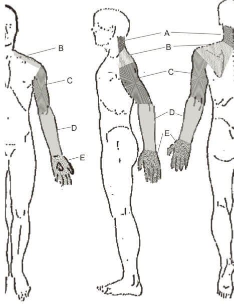 Forearm Pain (Lower Arm) Causes – Muscles, Nerves and Bones - (updated in 2022)