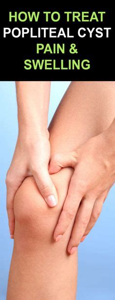 Popliteal Cyst