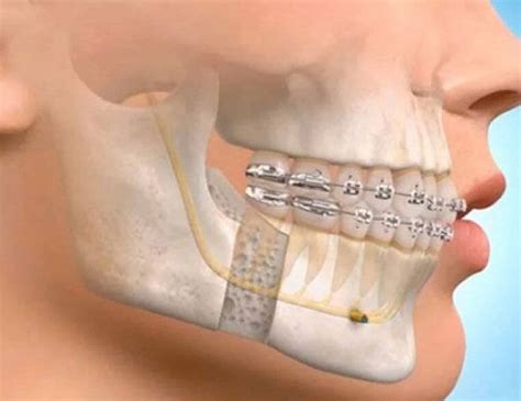Oral and Maxillofacial - Rangadore Memorial Hospital