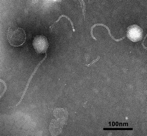 Transmission electron microscope image of phage JH01 | Download Scientific Diagram