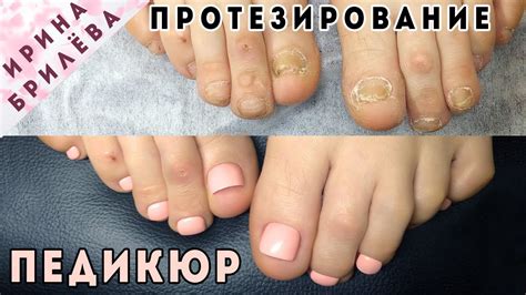 Сложный ПЕДИКЮР 👣 Укрепление ногтей полигелем - YouTube
