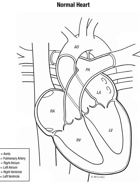 Congenital Heart Defects – Ohio Fetal Medicine Collaborative