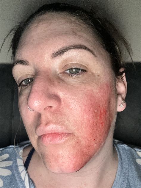 Petition · Make IV Fluids a Viable Treatment Option For PoTS patients
