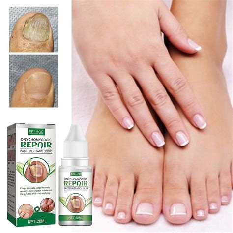 Nail Care for Toenails, Nail Repair, Protection & Strengthening Brittle