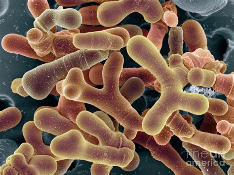 Bifidobacterium Animalis Bacteria Photograph by Dennis Kunkel ...