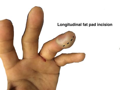 prison cell  powerhouse  shocking story   reformed felon