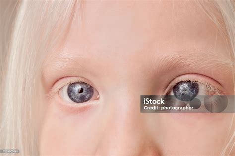 Closeup Photo Of Albino Child Eyes Stock Photo - Download Image Now ...